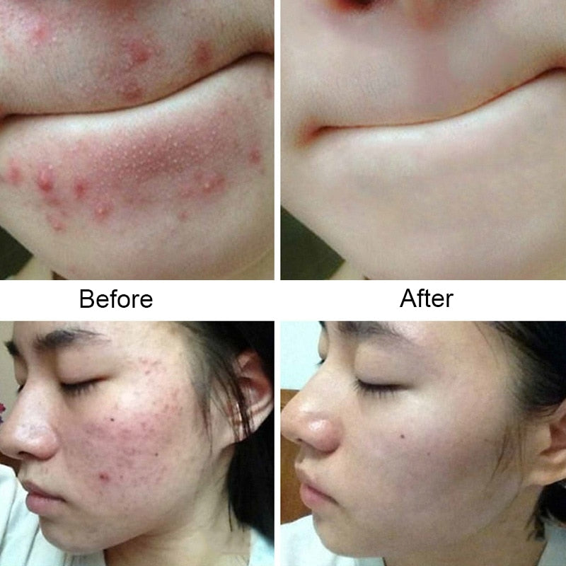 Sea Salt Purifying Skin Bar — Natural Skin Renewal