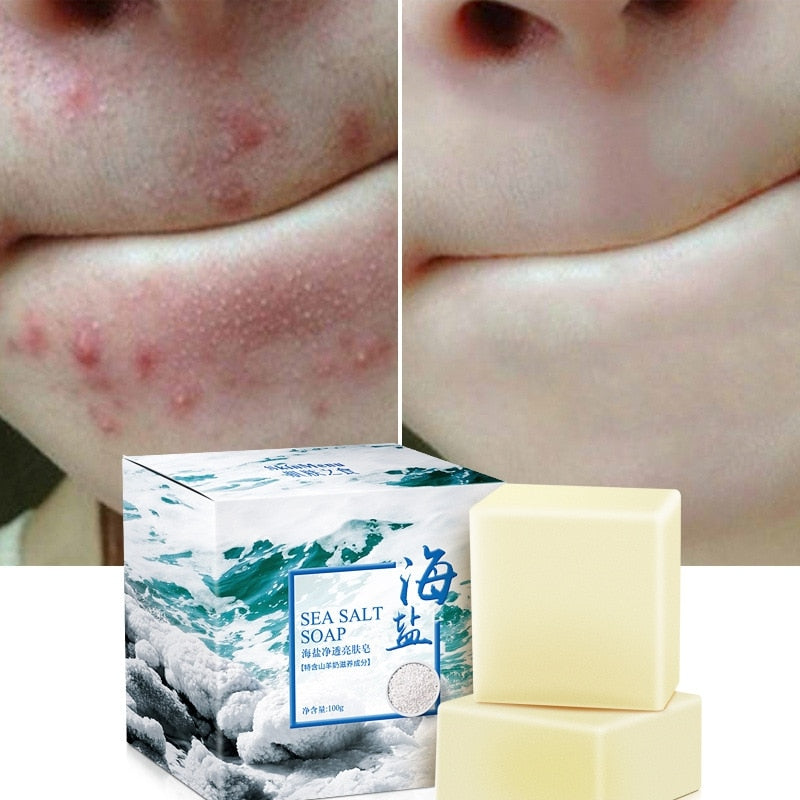 Sea Salt Purifying Skin Bar — Natural Skin Renewal