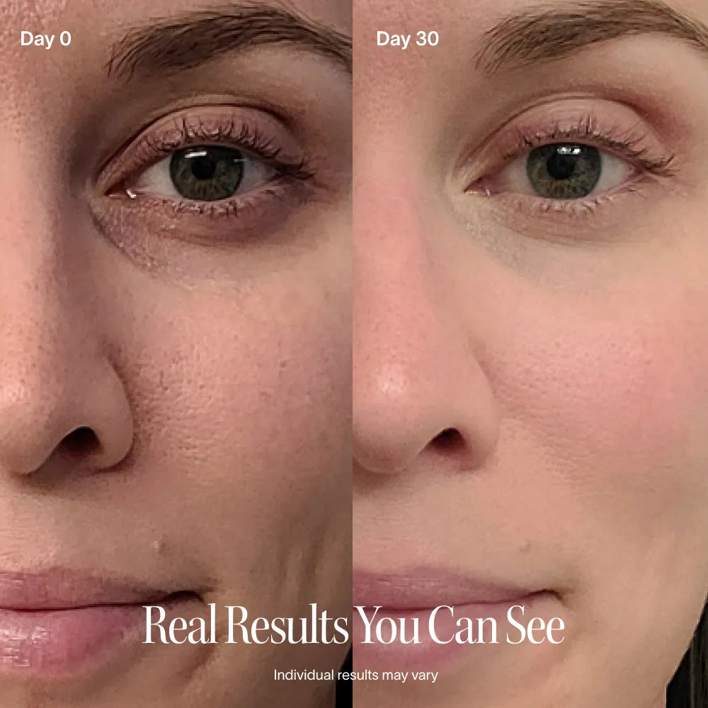 Solawave 4-in-1 Skincare Wand & LightBoost Serum Kit