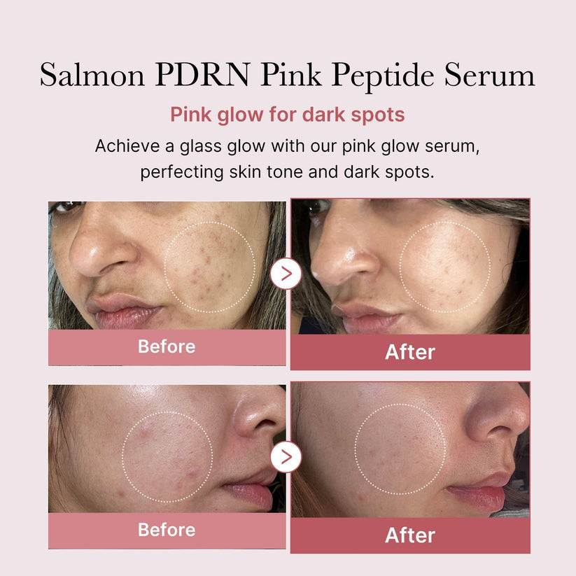Medicube PDRN Pink Peptide Brightening Glow Serum | Collagen, Hydrating & Firming Essence | Korean Skincare | 30ml